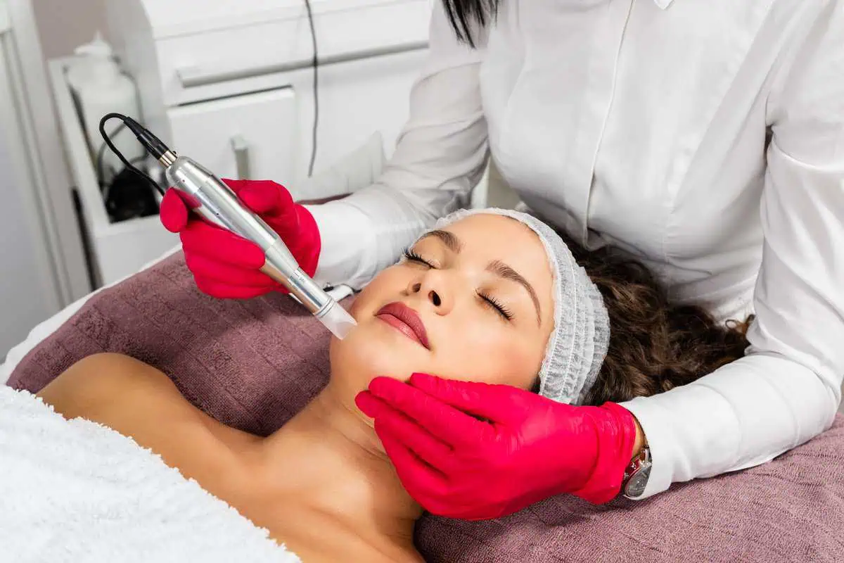 Microneedling With PRP treatment by Cherry Medical Aesthetics in Denver CO
