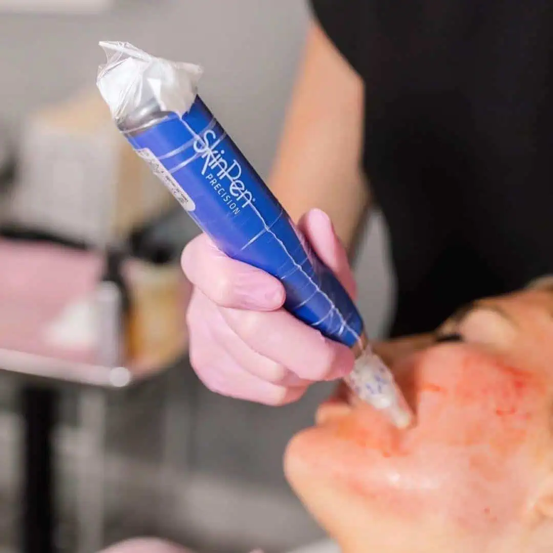 Microneedling Face & Neck 3 Pack $1,000