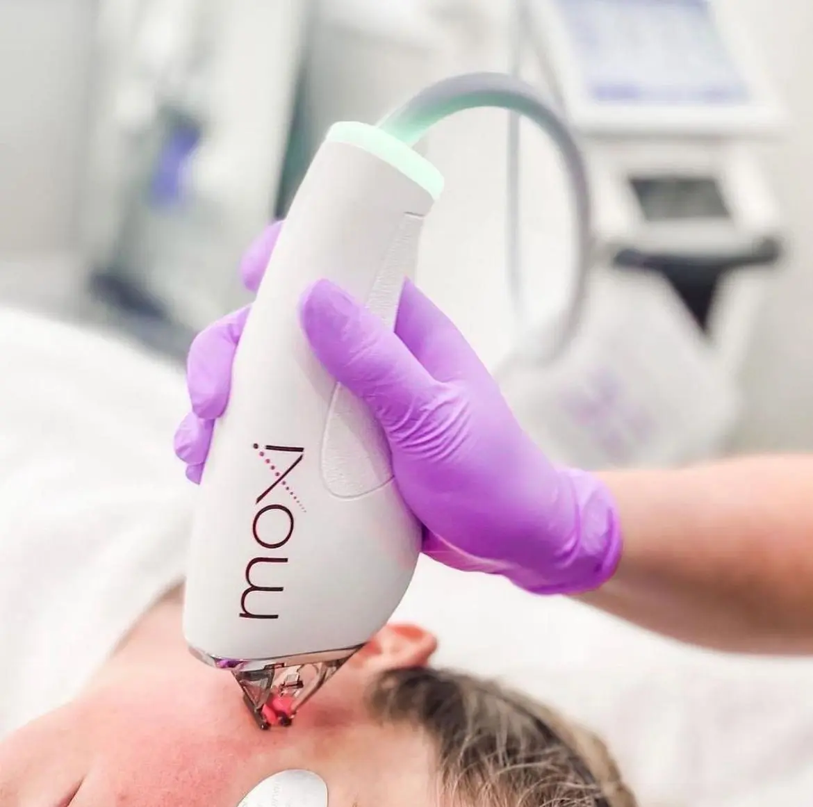 Moxi Face Neck Chest | Cherry Medical Aesthetics in Denver, CO