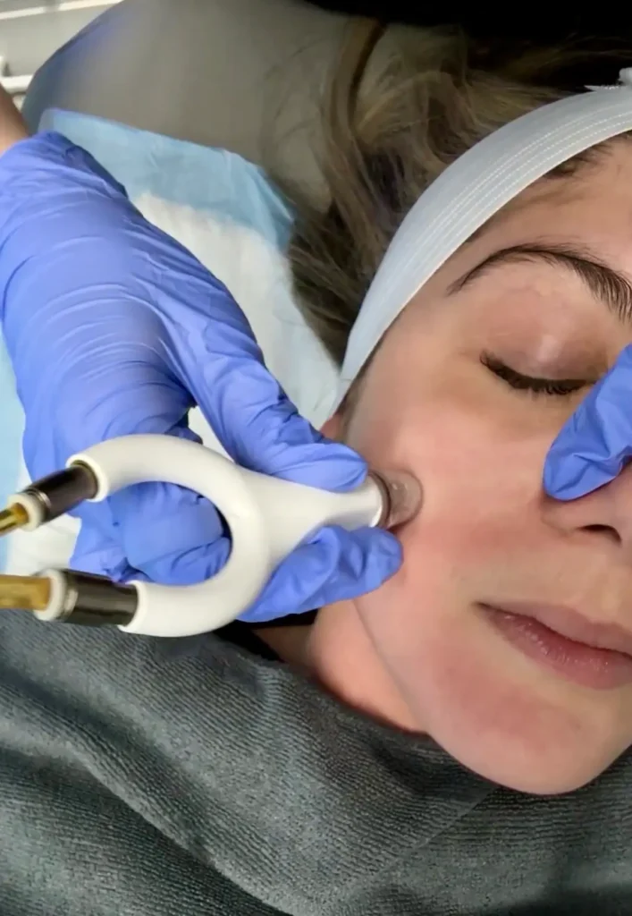 Facials Treatment in Denver, CO by Cherry Medical Aesthetics in Denver, CO
