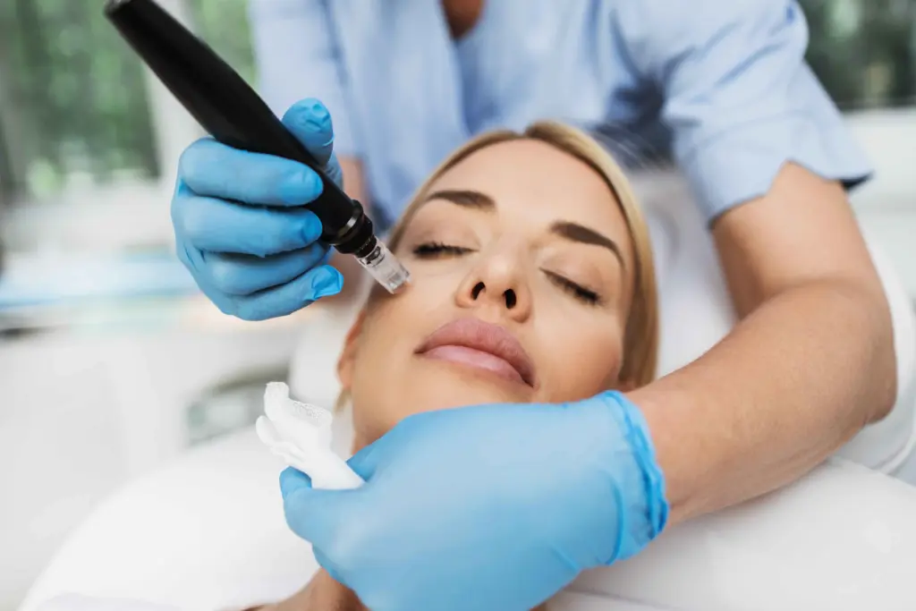 Body Microneedling with PRP