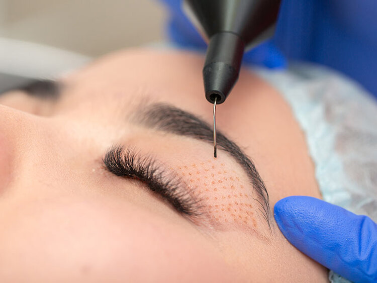 What rejuvenation do you specialize in? | Cherry Medical Aesthetics | Denver