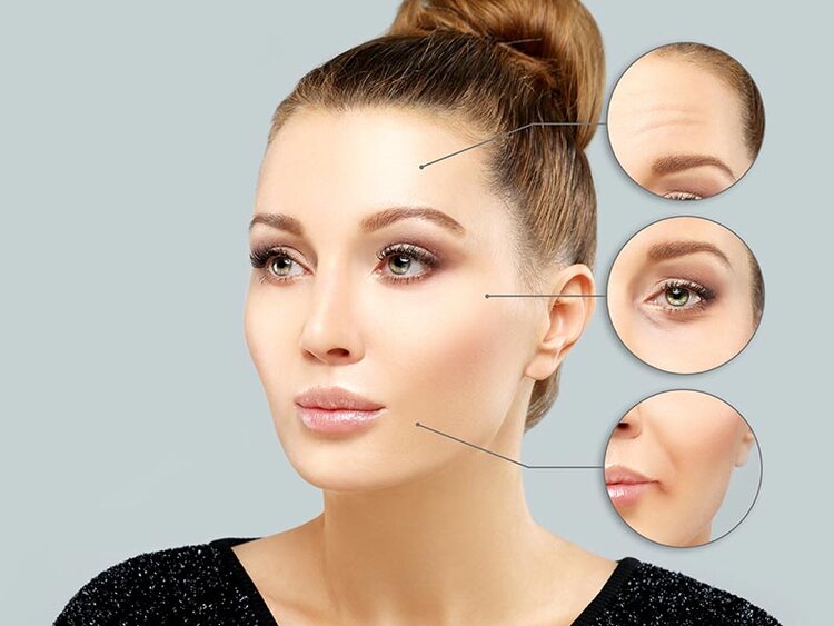 Why choose Botox? | Cherry Medical Aesthetics | Denver