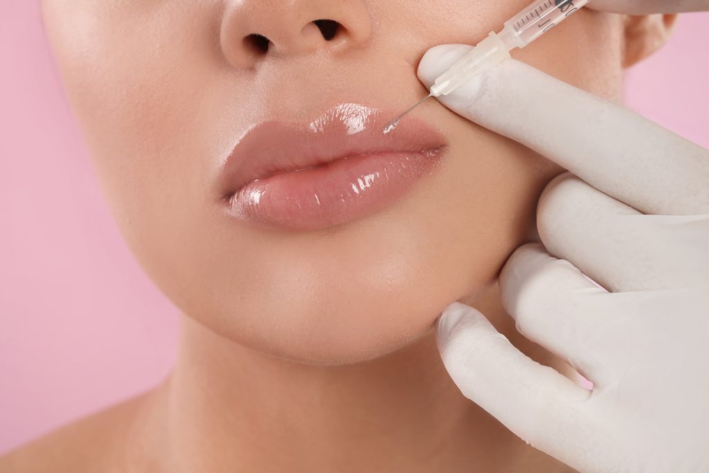 Restylane Refyne, Defyne, Silk, & Lyft Filler for Lips & Cheeks