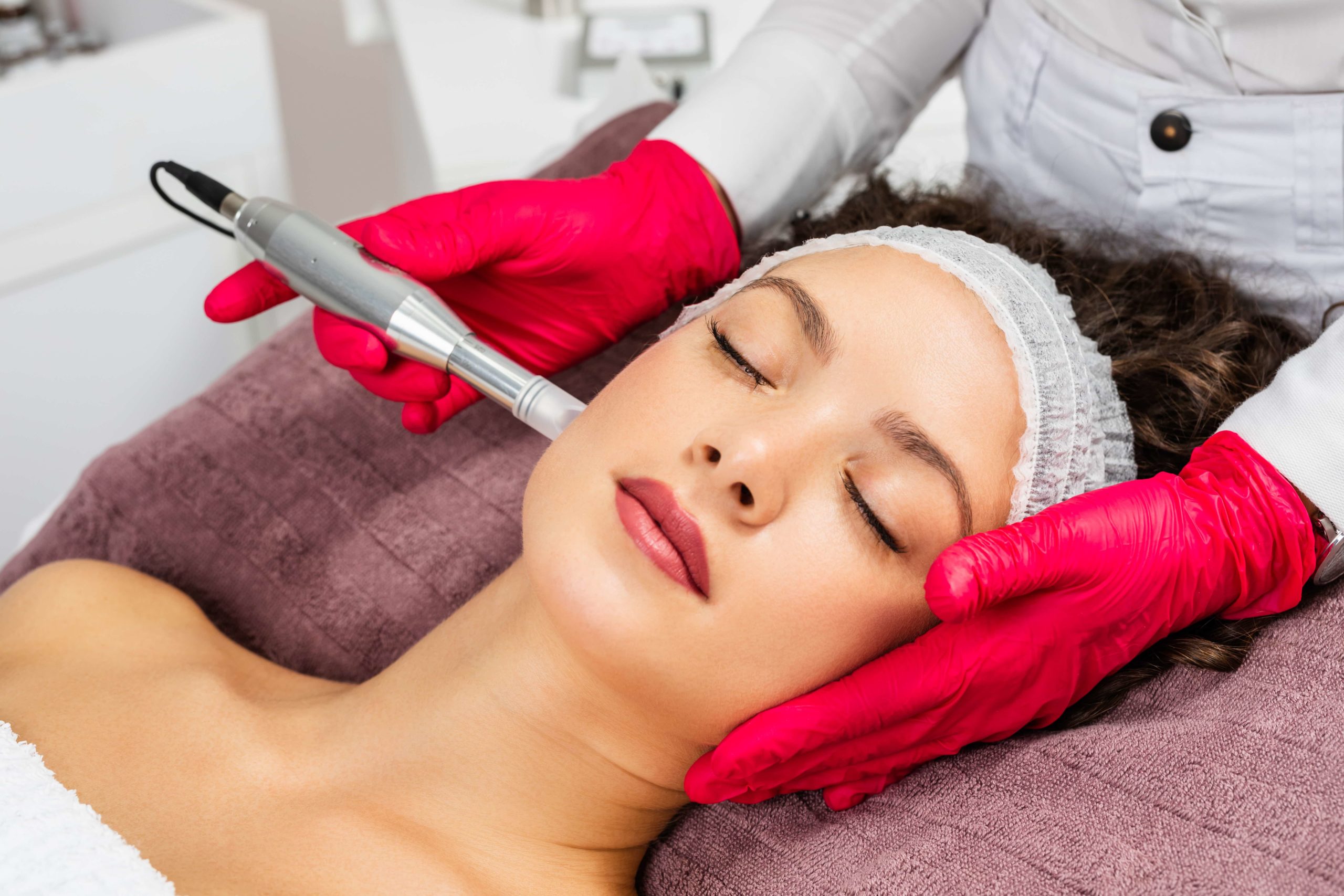 What is PRP Microneedling and its Benefits